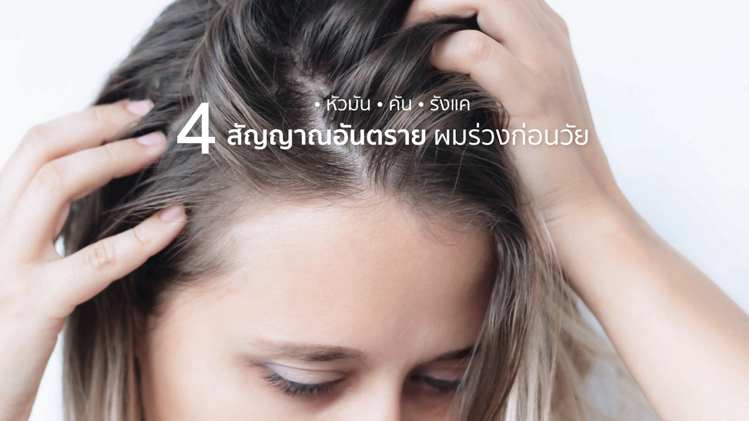 หัวเหม็น หัวมัน คัน รังแค 4 สัญญาณเตือนต้นเหตุผมร่วง รีบแก้ก่อนรากผมพัง