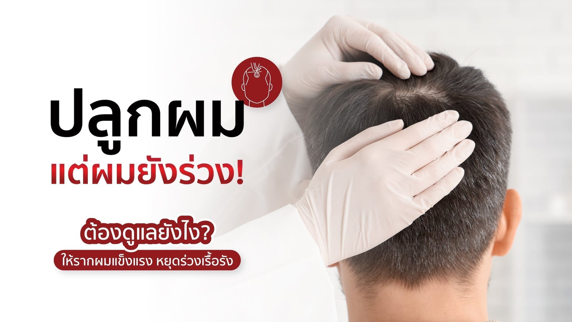 ปลูกผมแล้วผมร่วง ปกติไหม? เข้าใจ Shock Loss และวิธีดูแลรากผมให้แข็งแรง