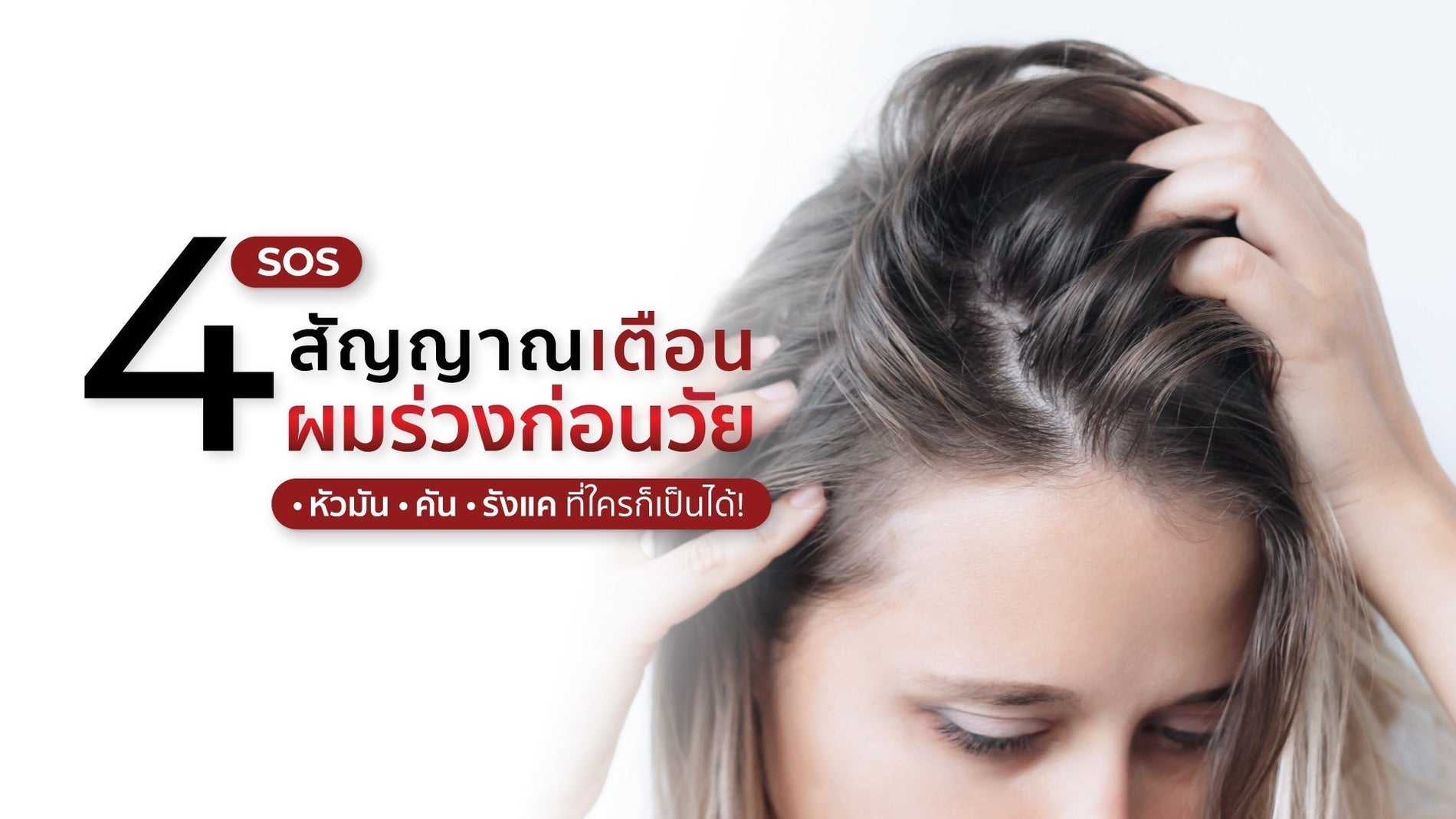 หัวเหม็น คัน มัน รังแคมาเต็ม? 4 อาการนี้อาจกำลังพาไปสู่ผมบางก่อนวัย