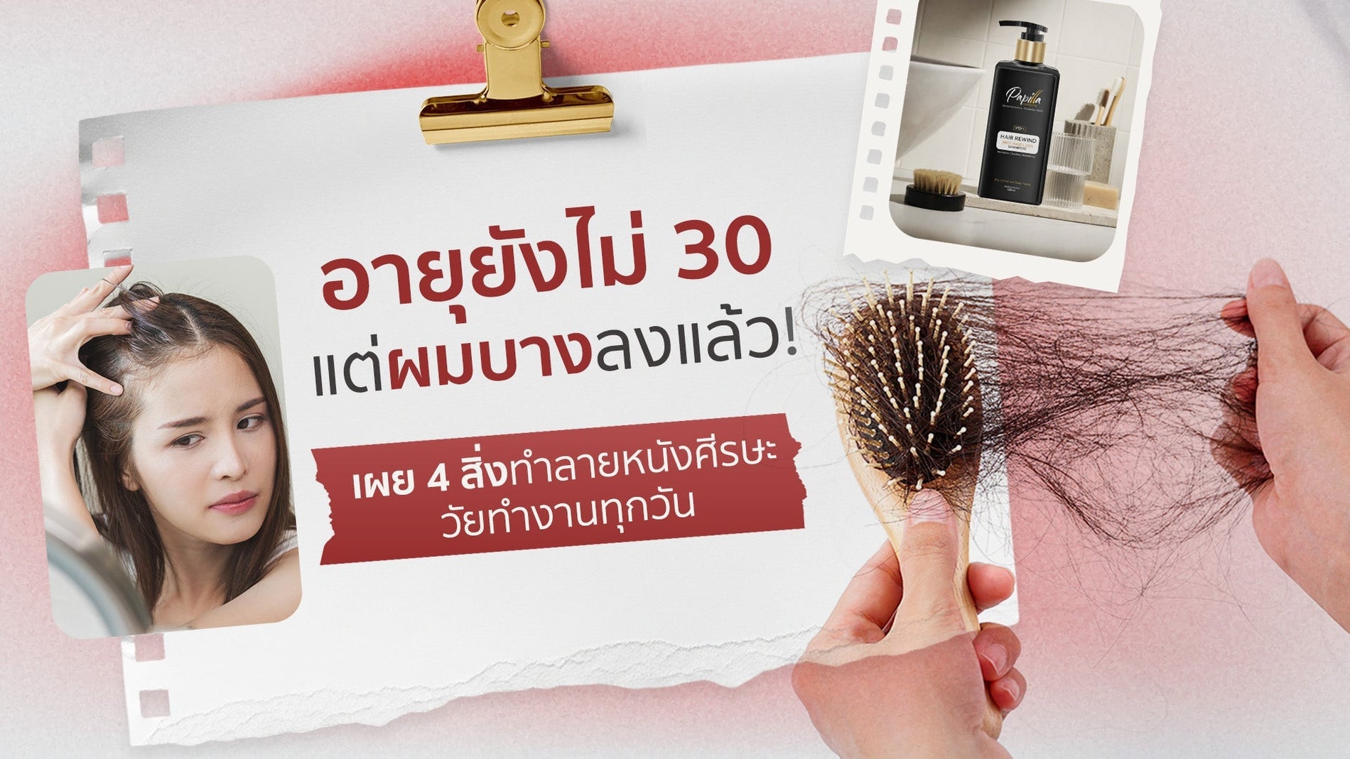 อายุยังไม่ 30 แต่ผมบางลงแล้ว ! เผย 4 สิ่ง ทำลายศีรษะวัยทำงานทุกวัน